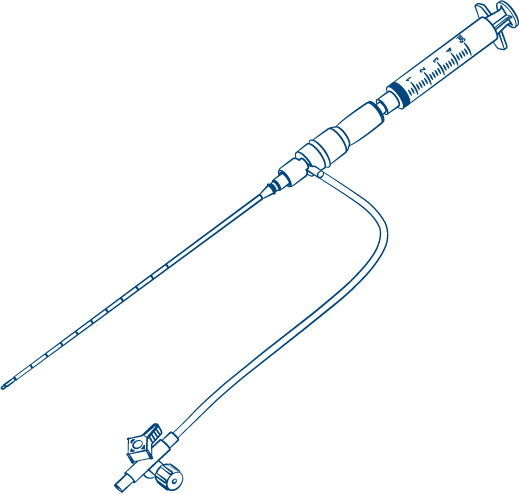 Illustration Saft-T-Centesis Nadel